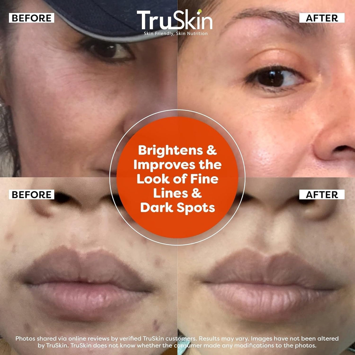 TruSkin Vitamin C Serum For Face – Anti Aging Formula with Vitamin C, Hyaluronic Acid, Vitamin E – Brightening Serum – Improve Appearance of Dark Spots, Tone, Fine Lines & Wrinkles, 1 Fl Oz